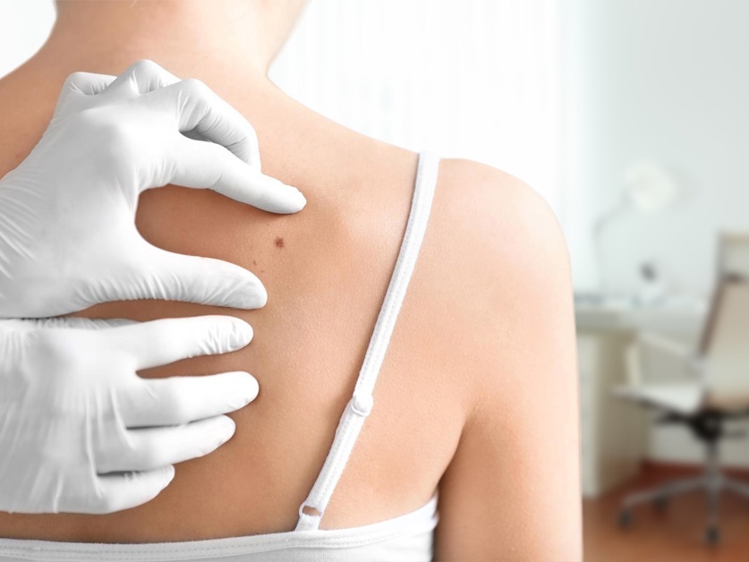 Kožní ambulance - MUDr. Jindra Zipfelová